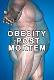 Obesity: The Post Mortem (2016) M4uHD Free Movie